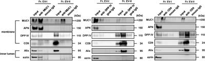 Distinguishing two distinct types of salivary extracellular vesicles: a potential tool for understanding their pathophysiological roles